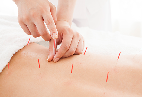 acupuncturist_05